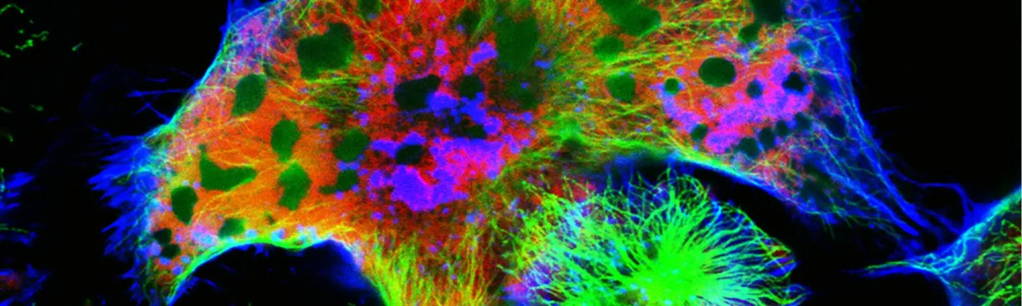 Neuroblastoma - objawy, rokowania, przyczyny, leczenie