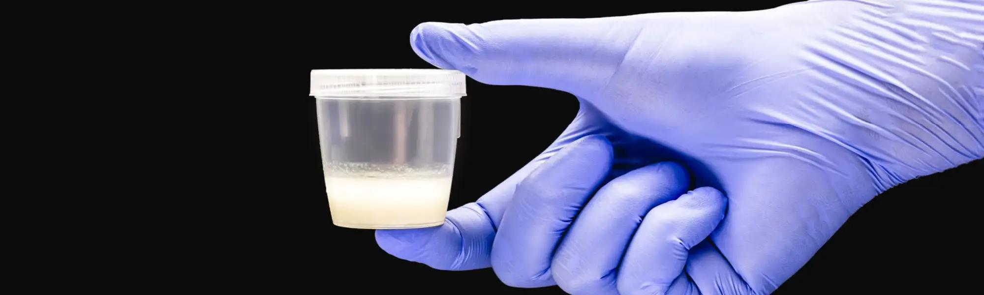 hand using Nitrile glove for male semen or sperm collection