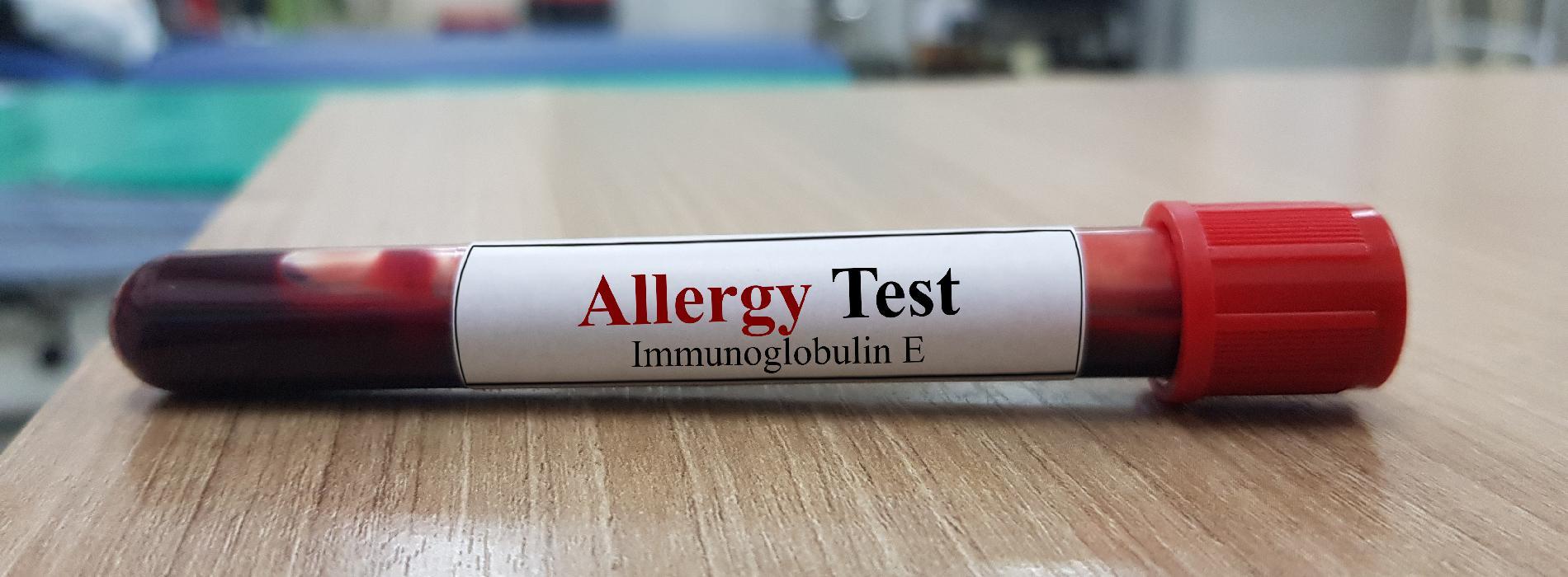 Alergia pokarmowa - testy diagnostyczne