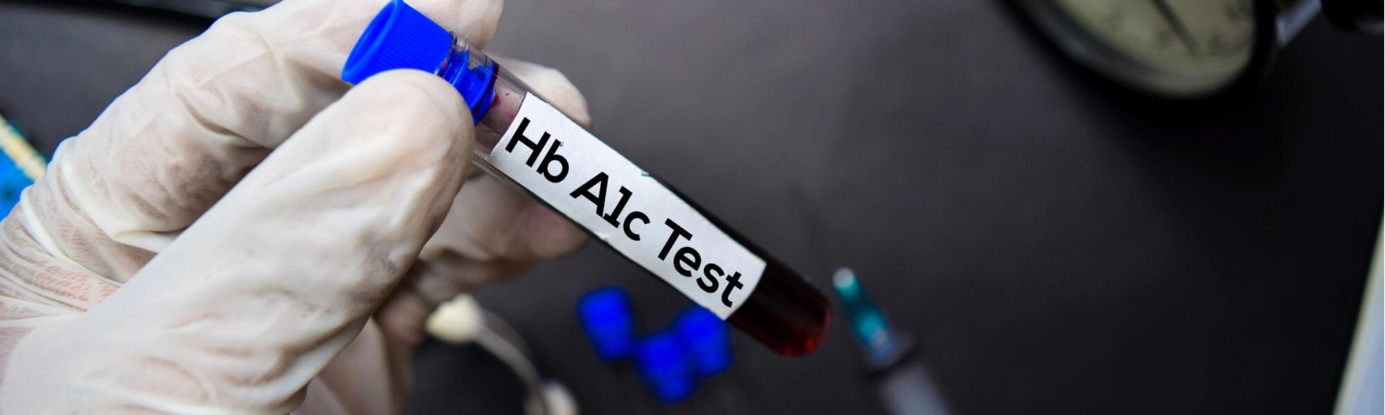 Hemoglobina glikowana HbA1c - normy, jak obniżyć