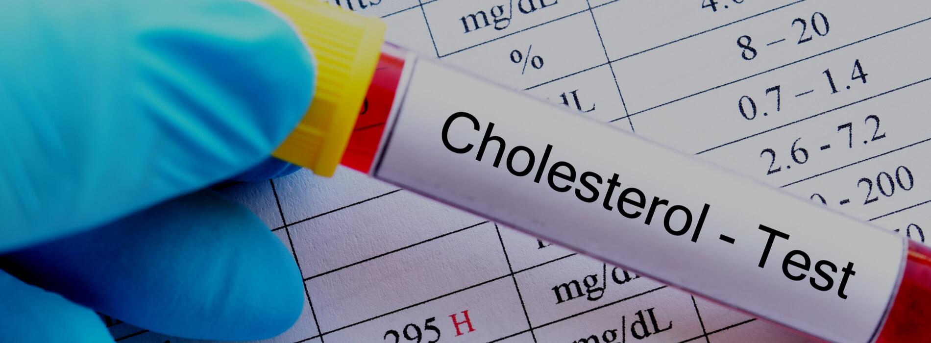 Hipercholesterolemia - przyczyny, objawy i leczenie