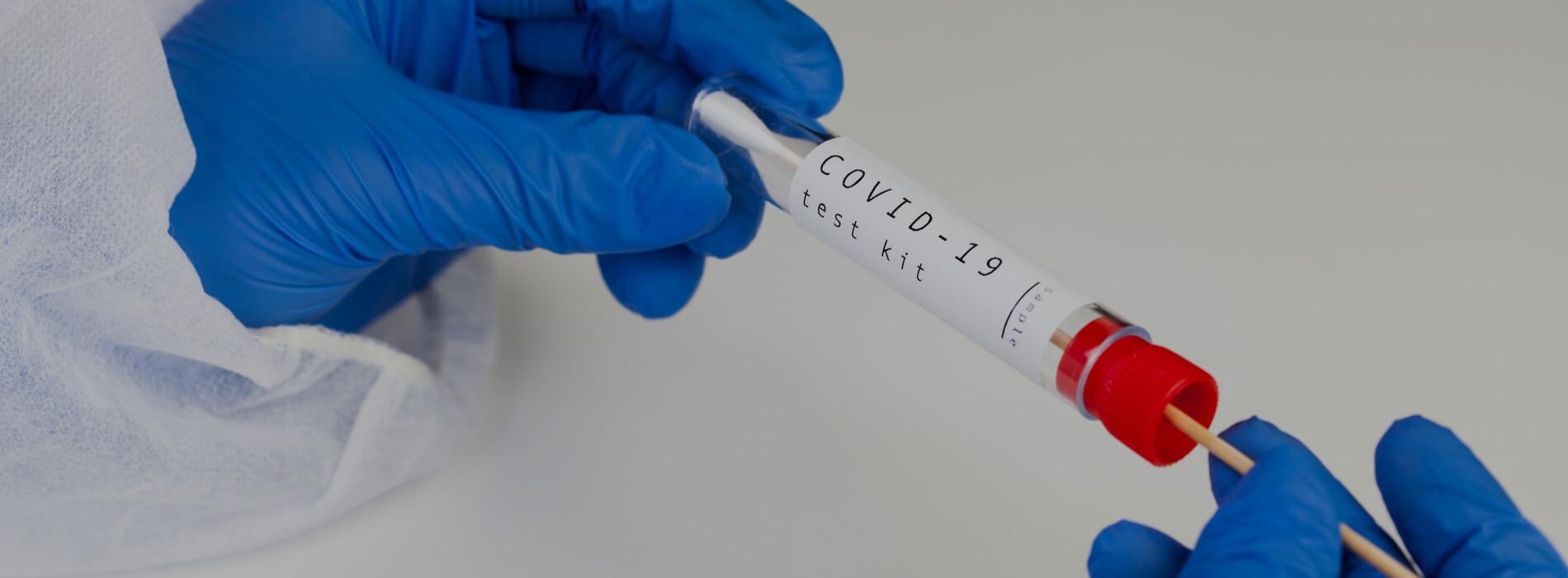 Test RT-PCR a test antygenowy na koronawirusa – czym się różnią, który wybrać?