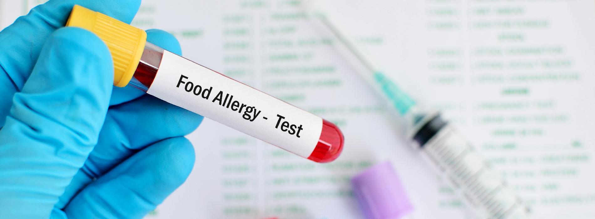 Testy alergiczne - jak zdiagnozować przyczynę alergii?