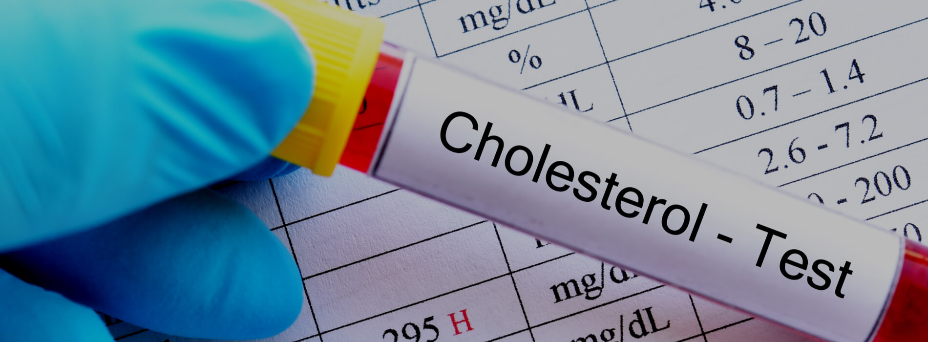 Hipercholesterolemia - Przyczyny, Objawy I Leczenie - Zdrowegeny.pl