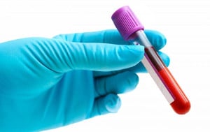 Immunoglobuliny IgG a nietolerancje pokarmowe