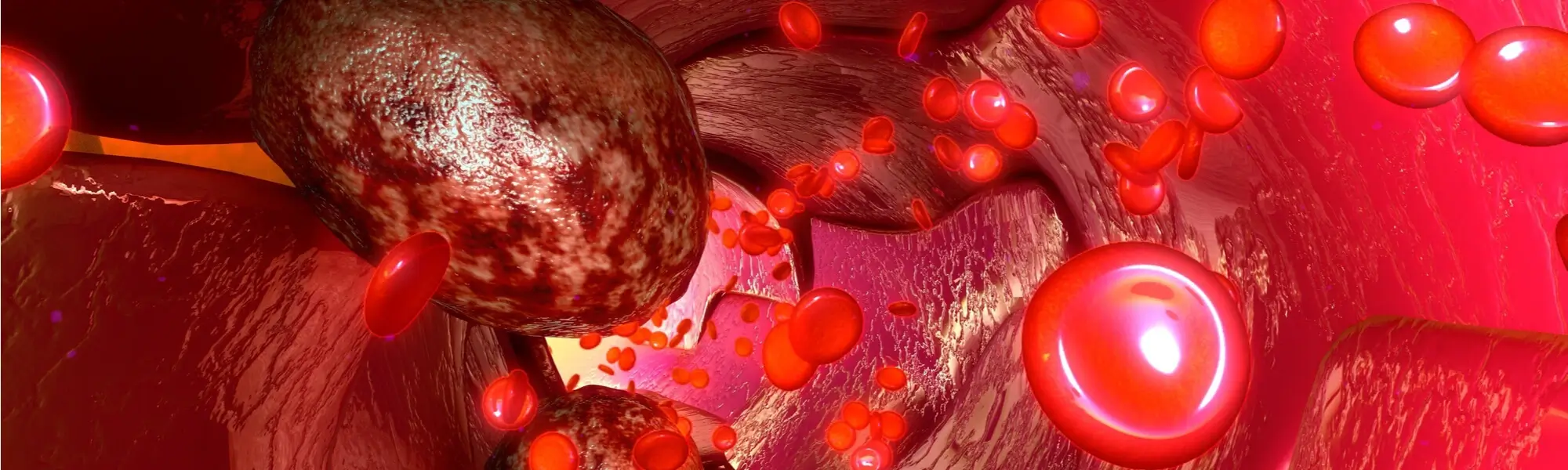 Jakie badanie krwi wykrywa raka? Test krwi na krążące komórki nowotworowe CTC