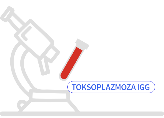Toksoplazmoza IgM