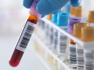 Rodzaje testów wenerycznych - badania serologiczne, mikrobiologiczne, molekularne
