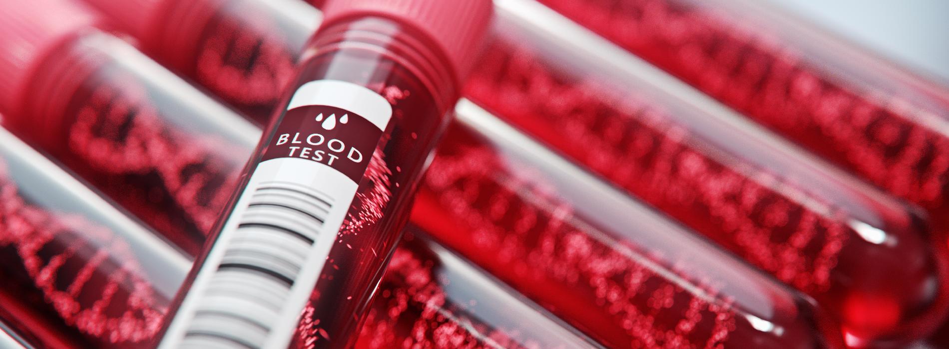 Test dna co to jest kto powinien go wykona zdrowegeny pl