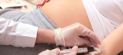 Test prenatalny SANCO - na czym polega, co wykrywa, kiedy wykonać?