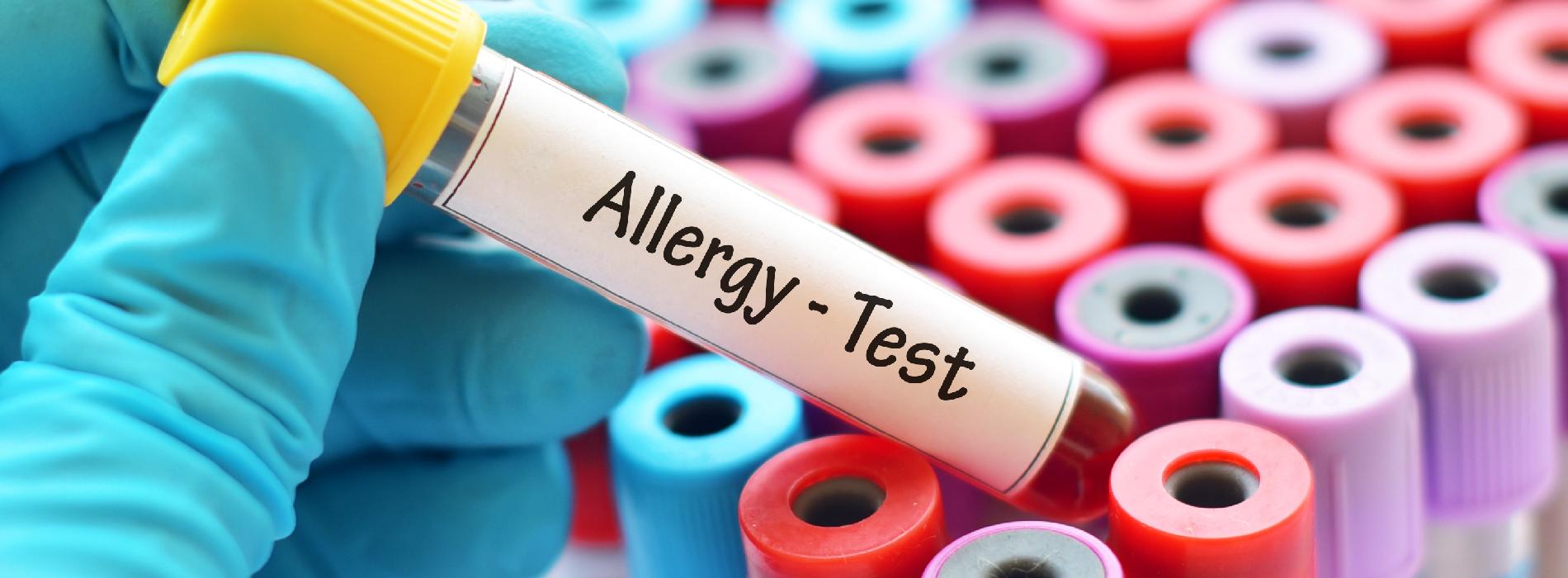 Testy alergiczne - jaka jest ich cena?