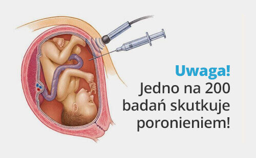 Amniopukncja - zagrożenie poronienia